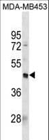PDCD2L Antibody (aa180-208)