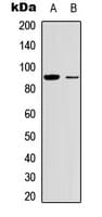 RPS6KA5 / MSK1 Antibody (Internal)