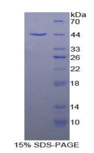 Human CD63 Protein (Recombinant His-GST)