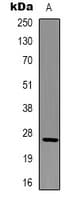 BCL2 / Bcl-2 Antibody