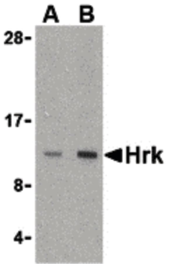 HRK / HARAKIRI Antibody