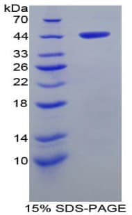 Rat AHSP / EDRF Protein (Recombinant His-GST)