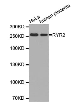 RYR2 / Ryanodine Receptor 2 Antibody