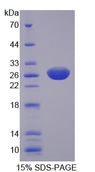 Human MEN1 / Menin Protein (Recombinant His)