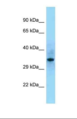 Polyclonal Rabbit anti-Human SHF Antibody (aa153-202, WB)