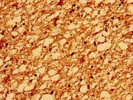TM6SF2 Antibody