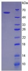 Human BIRC2 / cIAP1 Protein (Recombinant His-GST, N-terminus)