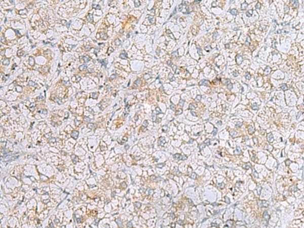 Polyclonal Rabbit anti-Human LRRC49 Antibody (IHC)