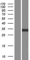 TSPAN3 Protein (Over-Expression Lysate Myc-DDK (Flag))