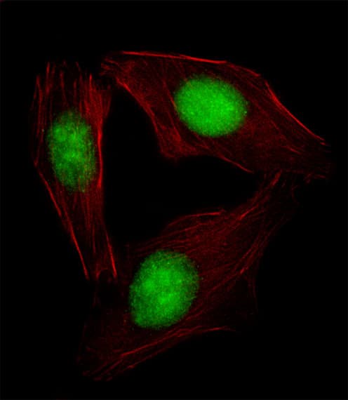 SREBF2 / SREBP2 Antibody (aa399-427)