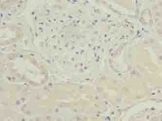 CKS2 Antibody