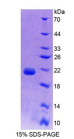 Chicken CALM1 / Calmodulin Protein (Recombinant His)