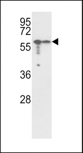 Vimentin Antibody (aa152-181)