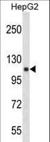 ANKRD18A Antibody (aa260-289)