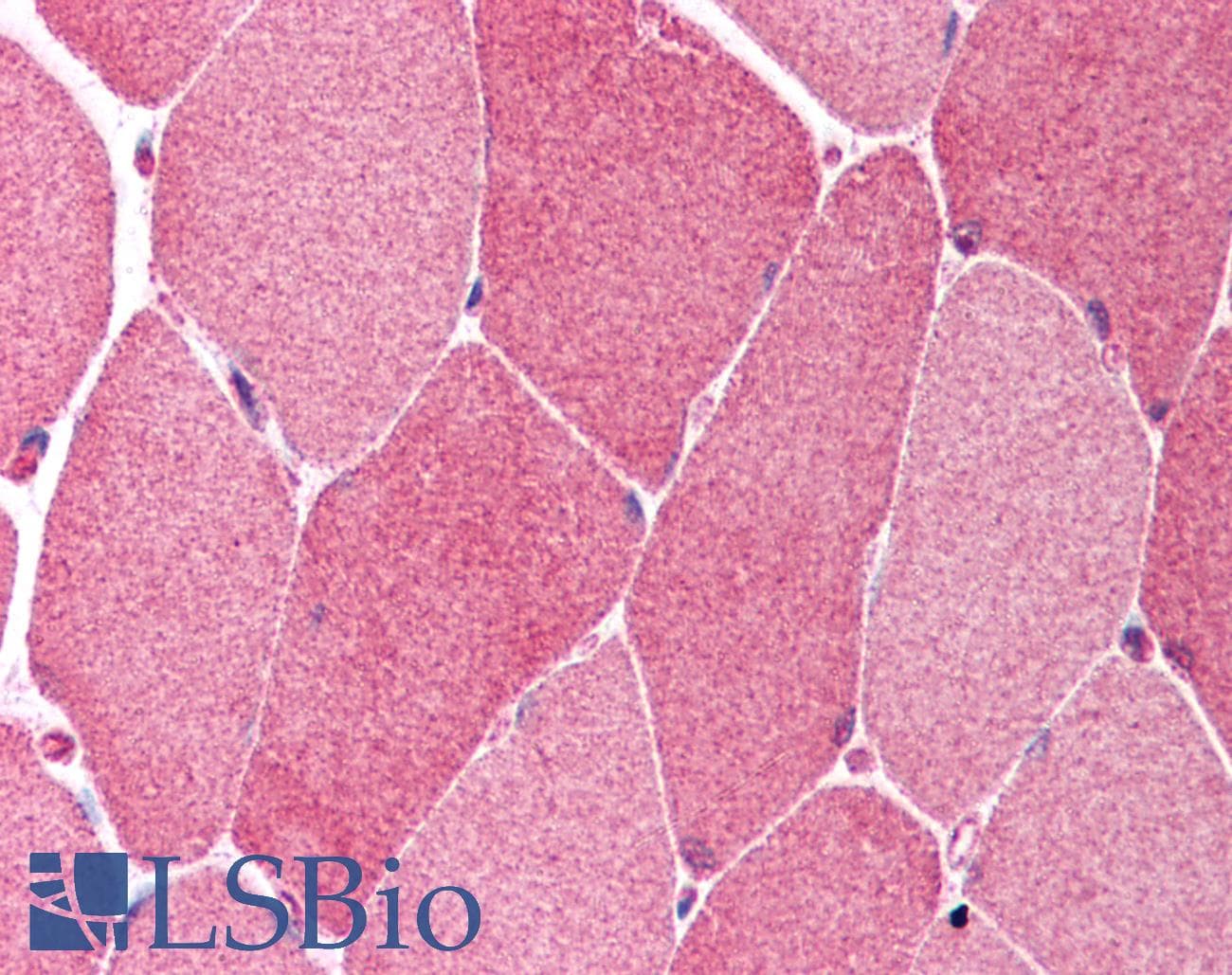 PathPlus™ BCL10 / BCL-10 Antibody (aa5-19)