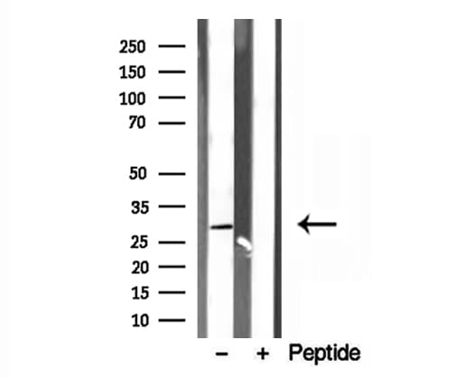 RAB3D Antibody
