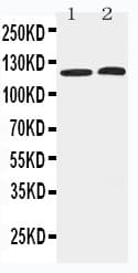 HDAC5 Antibody (aa626-644)