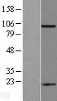 Human FOLH1 / PSMA Protein (Over-Expression Lysate Myc-DDK (Flag))