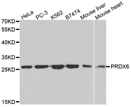 Polyclonal Rabbit anti-Human PRDX6 / Peroxiredoxin 6 Antibody (IHC, IF, WB)