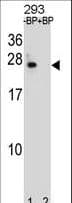 BCL2 / Bcl-2 Antibody (aa87-116)