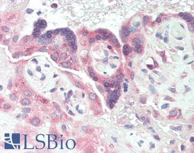 IHC-plus™ LSR / LISCH7 Antibody