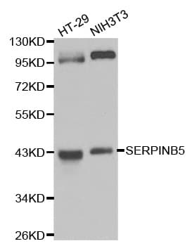 Polyclonal Rabbit anti-Human SERPINB5 / Maspin Antibody (IHC, WB)