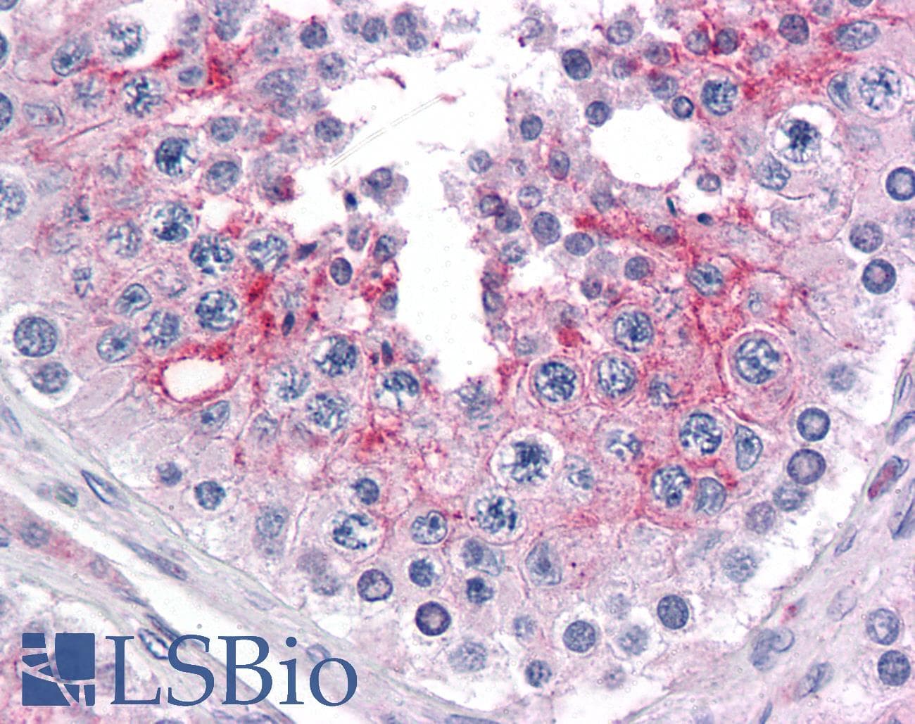 IHC-plus™ KPNA5 Antibody