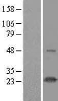 NOP16 Protein (Over-Expression Lysate Myc-DDK (Flag))