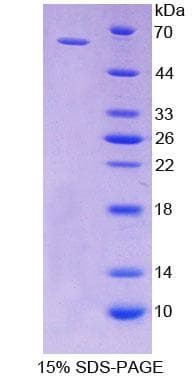 Rat CD19 Protein (Recombinant His-GST)