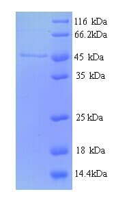 E. coli nrdB Protein (Recombinant His)