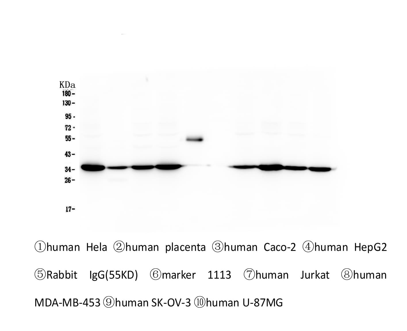 Monoclonal Mouse anti-Human EMD / Emerin Antibody (IHC, WB)