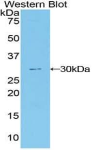 DNER / BET Antibody (aa339-583)