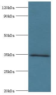 Polyclonal Rabbit anti-Human MSI2 Antibody (aa1-80, WB)