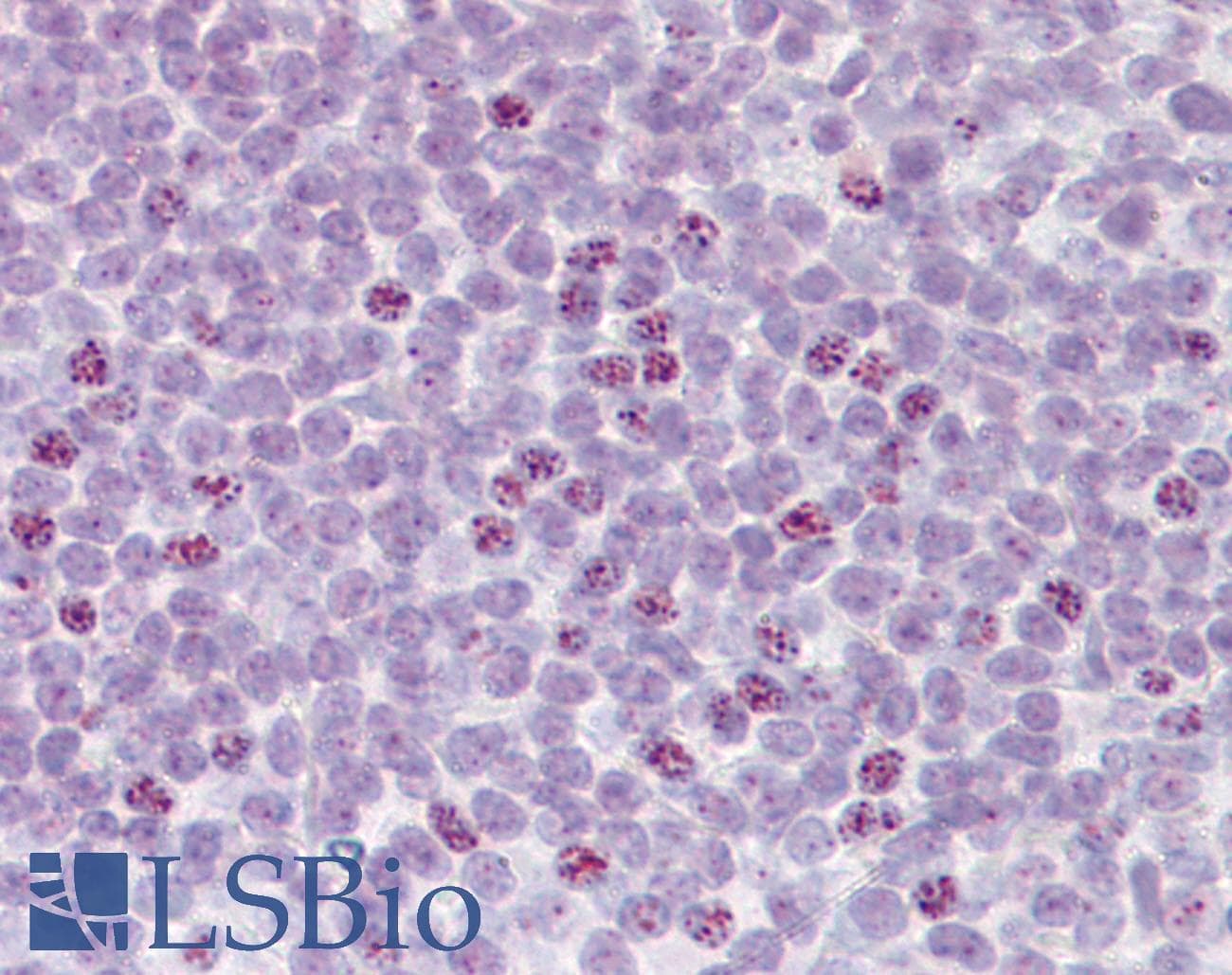 IHC-plus™ AICDA / AID Antibody (N-Terminus)