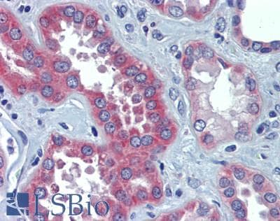 IHC-plus™ Mitofusin 2 / MFN2 Antibody