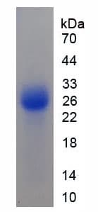 Mouse P450SCC / CYP11A1 Protein (Recombinant His)