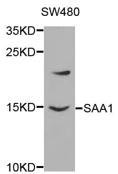 Polyclonal Rabbit anti-Human SAA1 / SAA / Serum Amyloid A Antibody (IHC, WB)