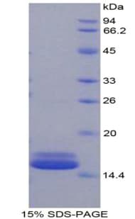Mouse FABP4 / AP2 Protein (Recombinant His)