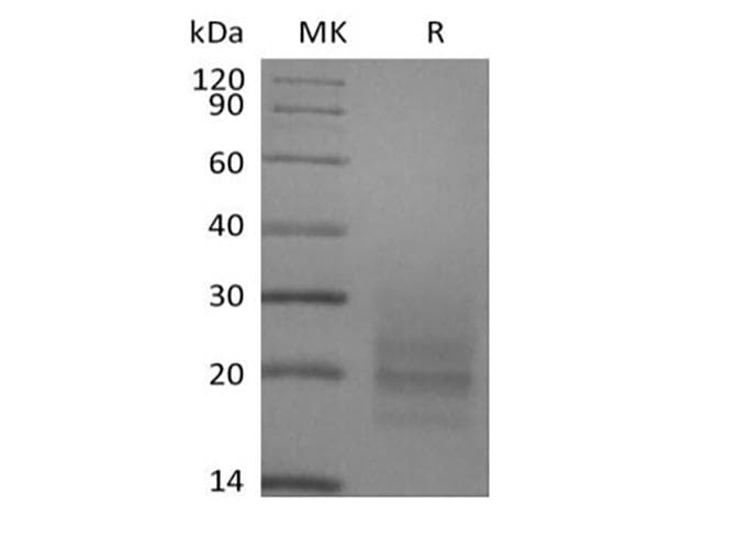 Human CD3E + CD3D Protein (Recombinant 6His, C-terminus)