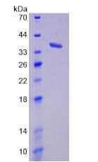 Mouse MCL1 / MCL 1 Protein (Recombinant His, N-Terminal)