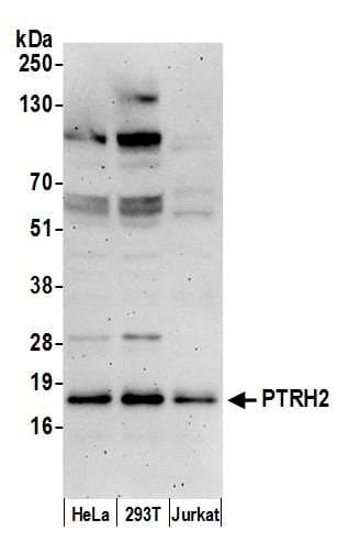 Polyclonal Rabbit anti-Human PTRH2 / BIT1 Antibody (aa129-179, WB)