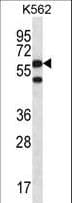 CCT8 Antibody (aa519-548)
