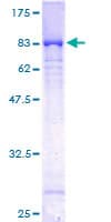 Human DLD / Diaphorase / E3 Protein (Recombinant GST)