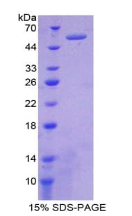 Human CFI / Complement Factor I Protein (Recombinant His-GST)