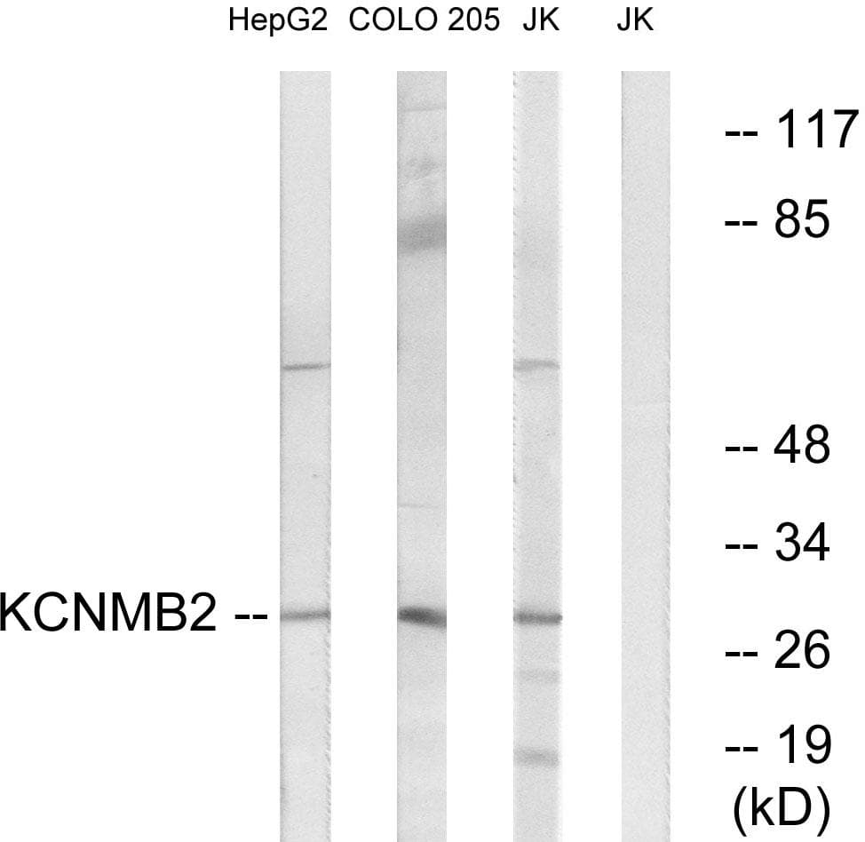 Polyclonal Rabbit anti-Human KCNMB2 Antibody (WB)