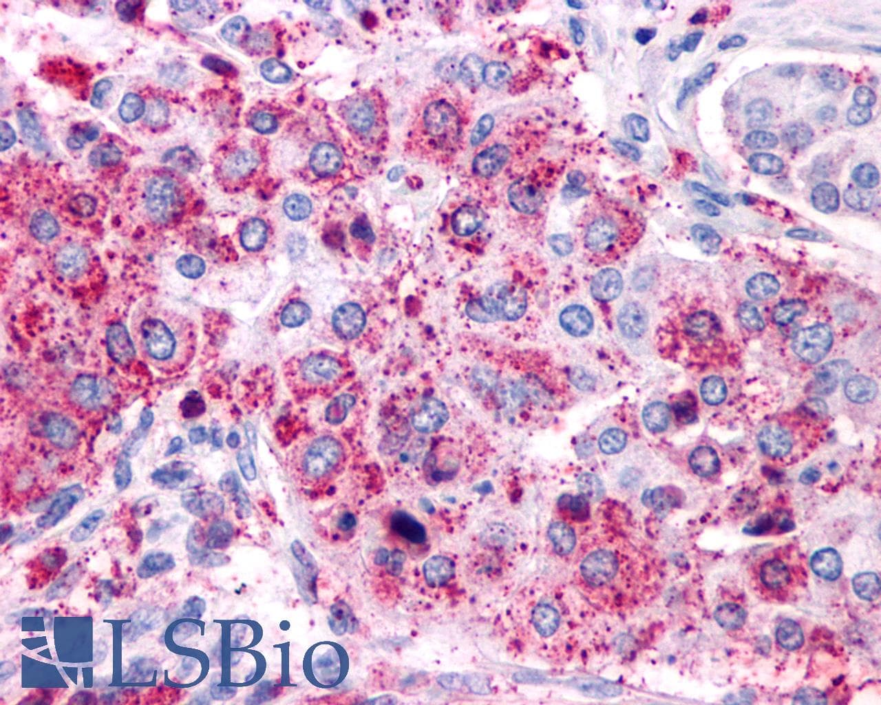 IHC-plus™ VIPR1 Antibody (Cytoplasmic Domain)