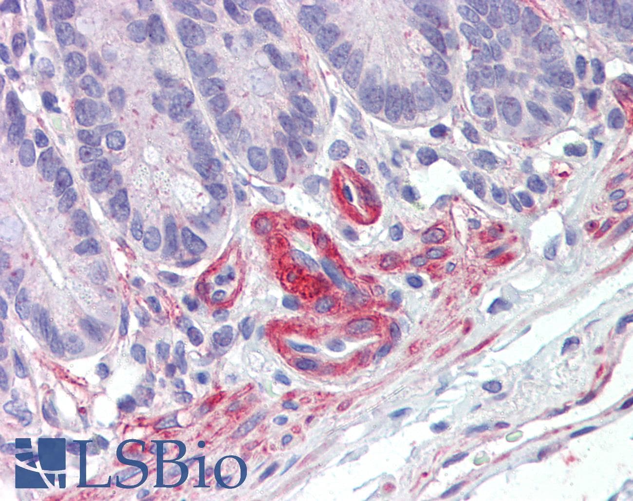IHC-plus™ PRKG Antibody