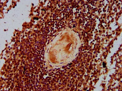 CBFA2T3 Antibody