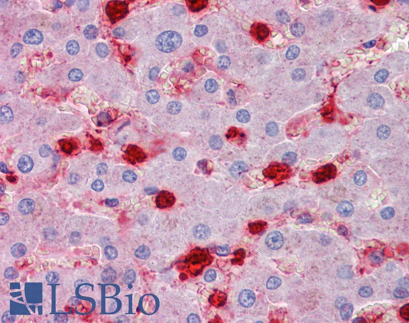 IHC-plus™ Polyclonal Goat anti-Human S100A9 / MRP14 Antibody (aa67-79, IHC, WB)