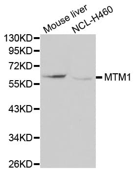 MTM1 / Myotubularin Antibody